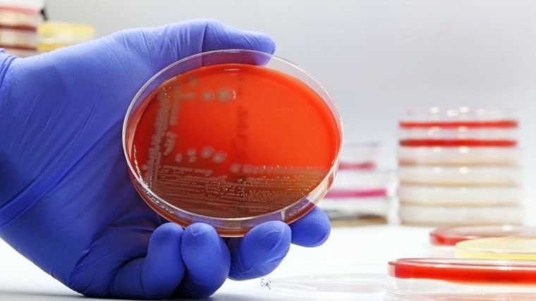 A microbiological culture Petri dish with a colonies of E. coli