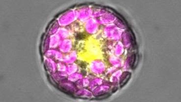 Plant cell (a protoplast) expressing the SUMO1 protein tagged with yellow fluorescent protein