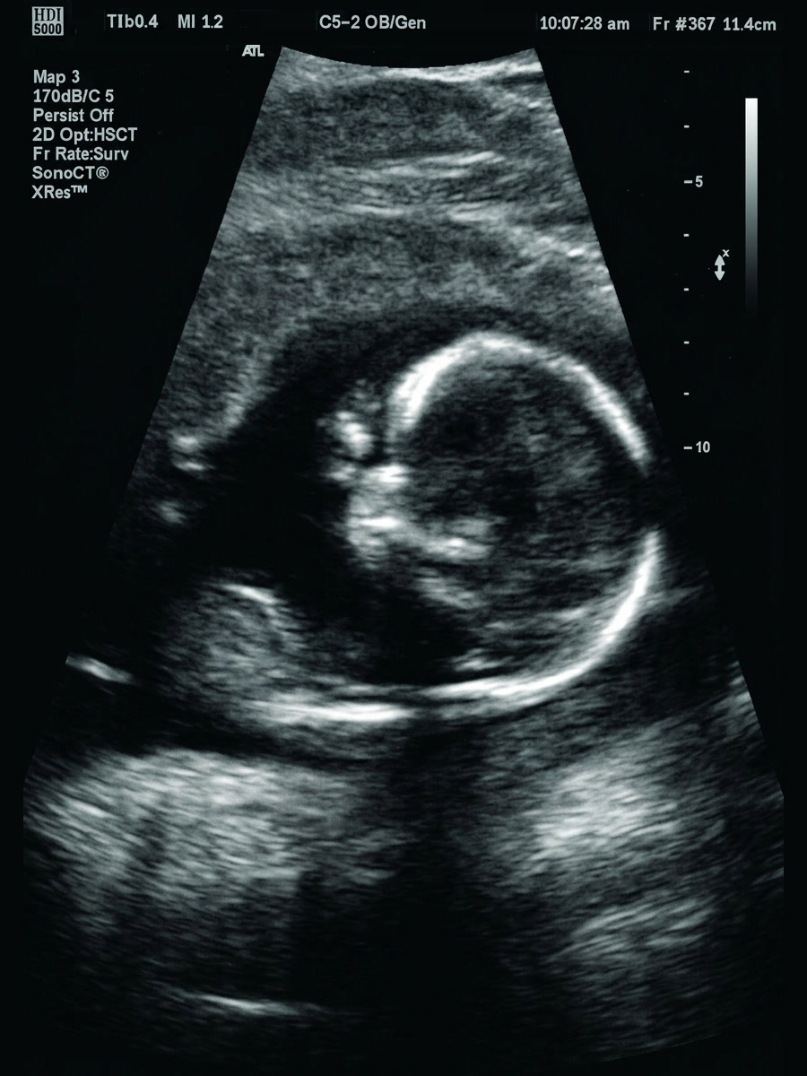 Medical imaging and AI research at Oxford